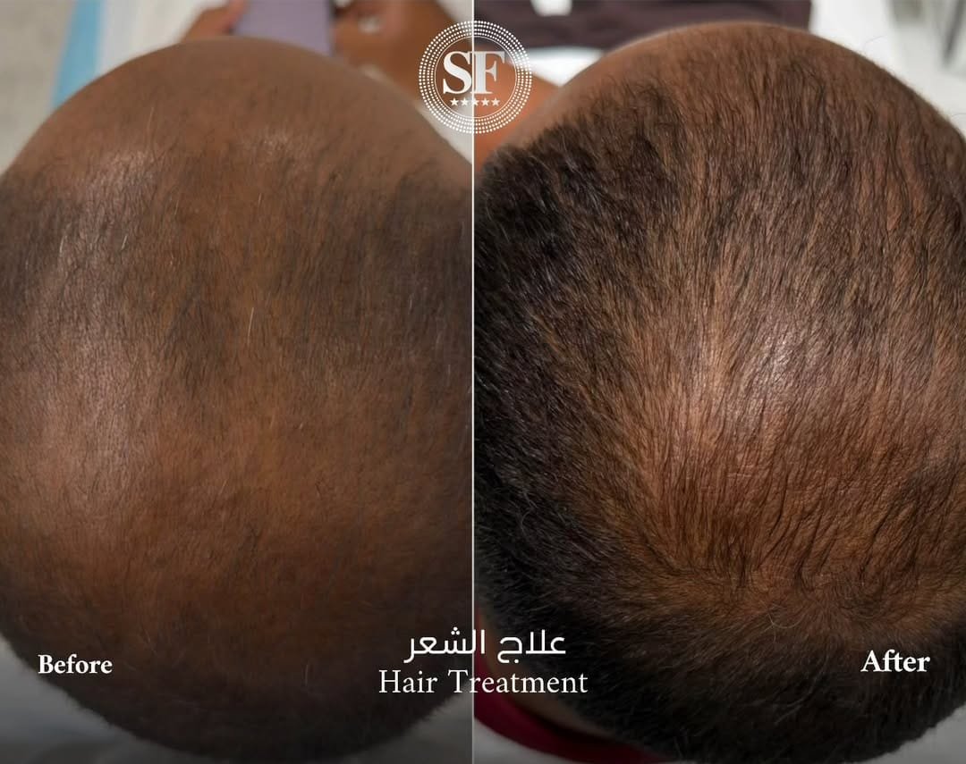 Home whatsapp image 2026 02 03 at 09.20.25