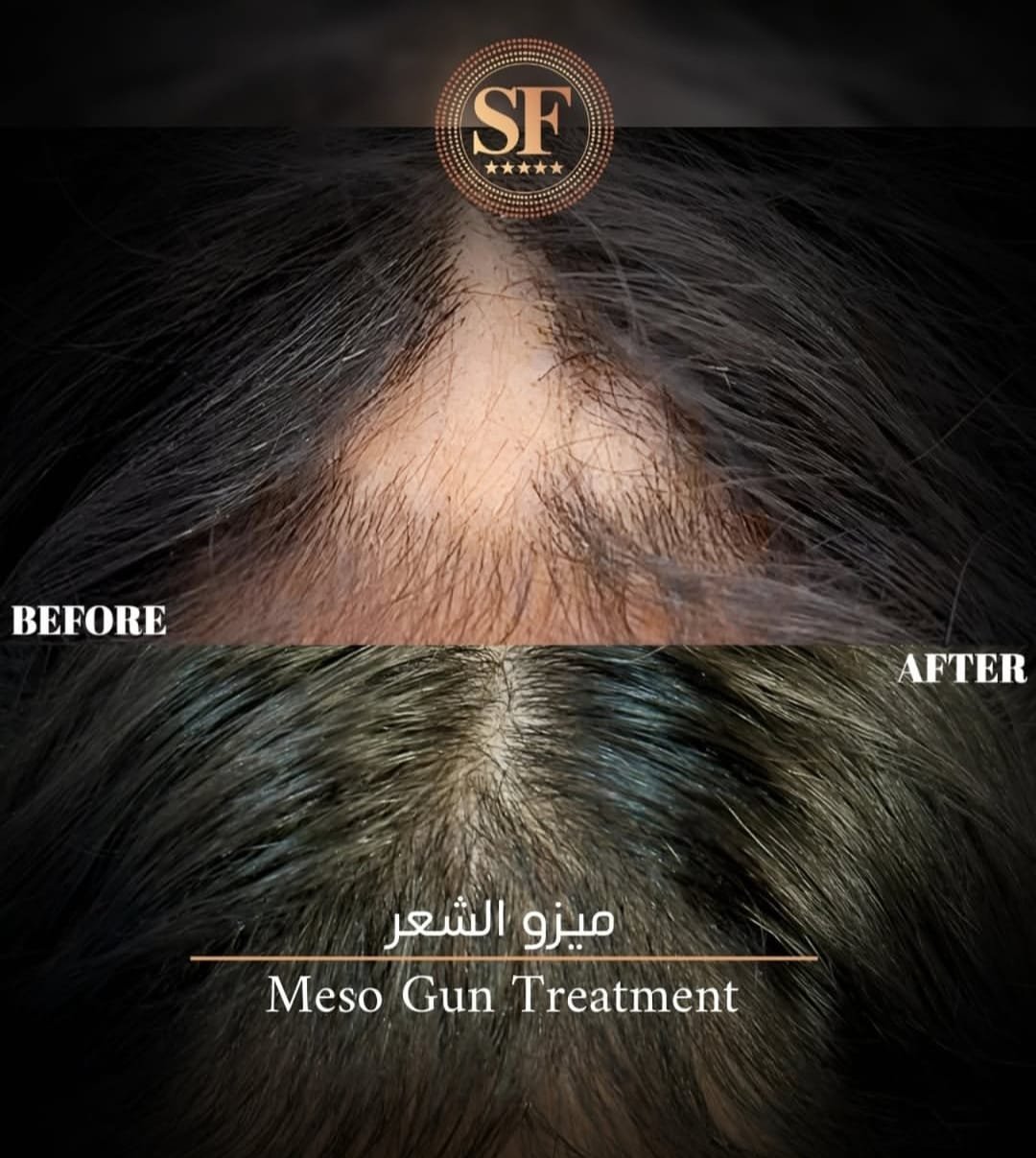 Home whatsapp image 2026 02 03 at 09.31.11